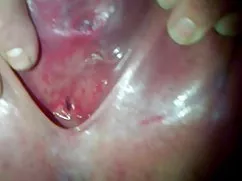 Squirting
